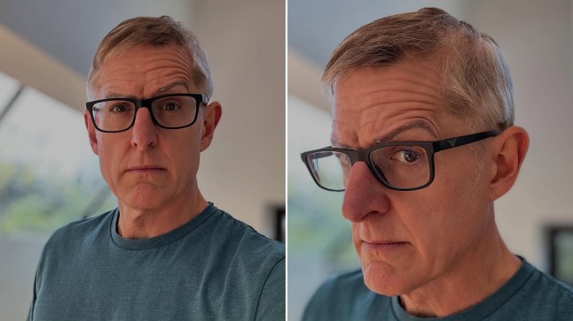 Louis Theroux shows off his new short hair as he prepares to shave his head due to alopecia