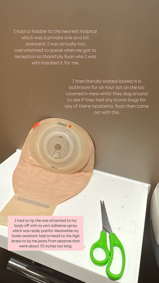 Louise Thompson's stoma bag breaks