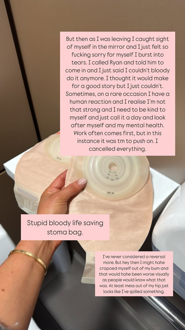 Louise Thompson's stoma bag breaks